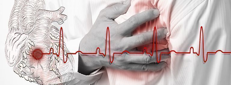 Enfermedades cardíacas siguen siendo la principal causa de muerte a pesar del COVID-19 y accidentes de tránsito